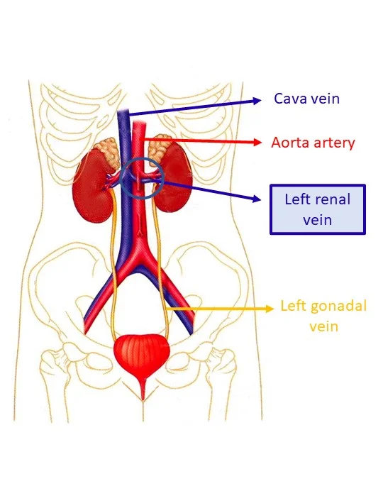 cascanueces venas y arterias